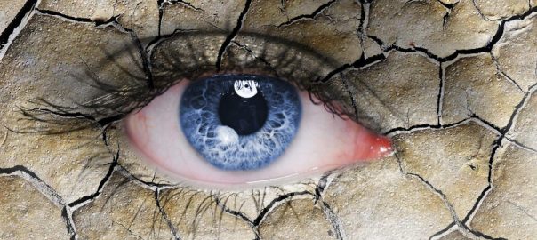 dry eye